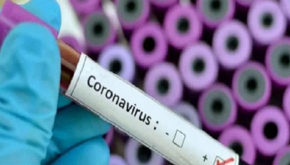 Las personas que fueron diagnosticadas con coronavirus en Áncash se divide en siete mujeres y siete varones, cuyas edades oscilan entre 26 y 73 años.