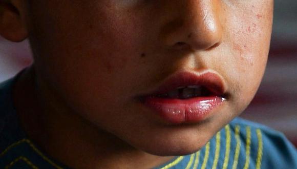 La increíble cifra de menores víctimas de abuso sexual que alarma a los colombianos. (AFP)