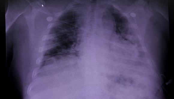Telecografía pulmonar surge como respuesta gracias a la telemedicina (Reuters/ Callaghan O'Hare)