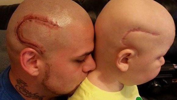 Niño fue operado para eliminar cáncer y su padre se tatuó la misma cicatriz  para apoyarlo | CHEKA | PERU21
