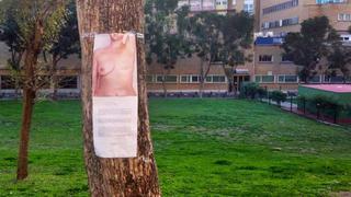 Mujer fotografió su pecho desnudo en protesta a largas listas de espera para reconstrucción mamaria