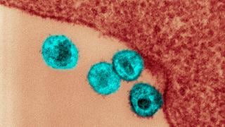 Nerdgasmo: Estos son algunos de los virus más letales de la historia (Parte II)