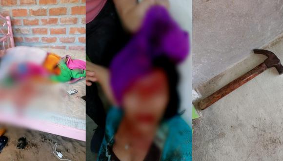 Sullana: mujer denunció a conviviente por atacarla a martillazos en la frente