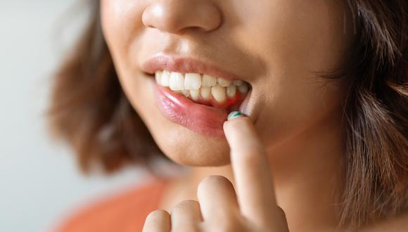 El experto destaca la importancia de la limpieza interdental y cepillado dental como prevención de enfermedades bucales. (Foto: Difusión).