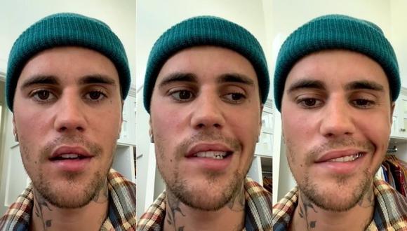 Justin Bieber confirmó a través de un video que sufre de parálisis facial. (Foto: Instagram)