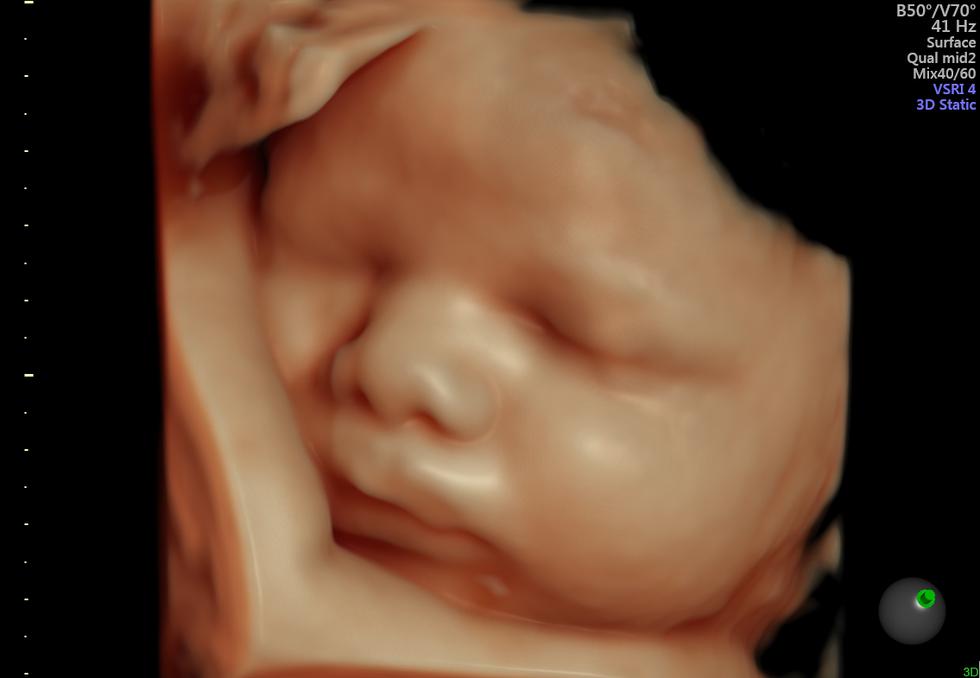 Así se ve un bebé en el vientre de una madre gracias a las ecografías en 5D/6D
