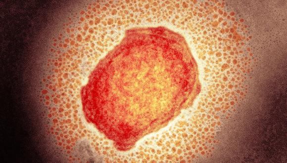 Partícula del virus de la viruela del mono.