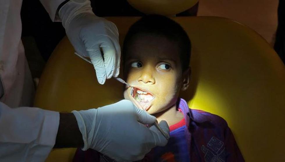 Médicos extrajeron más de 500 dientes de la boca de un niño en la India. | Reuters