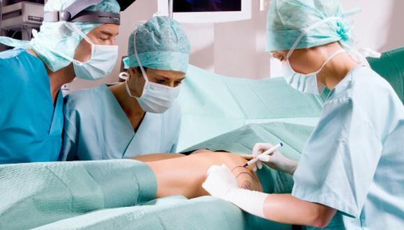 Cinco de las cirugías estéticas más sorprendentes que existen. (Getty)