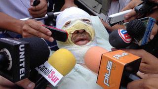 Bolivia: Ya son cuatro los encarcelados por quemar a periodista