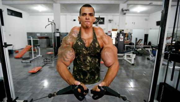 Brasil: Mira cómo quedó el 'Hulk humano' tras desinflarse los brazos para sobrevivir. (EFE)