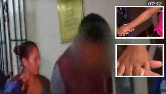 Madrastra golpeó a la niña de 7 años. (América TV)