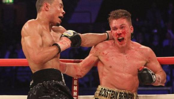 Boxeador británico en coma inducido tras brutal pelea por título en Londres. (Sopitas)