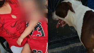 Niña de dos años quedó desfigurada tras ser atacada por perro pitbull en Huaura | VIDEO 