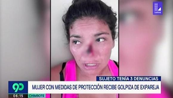 Mujer con medidas de protección recibió golpiza de expareja. (Captura: Latina)
