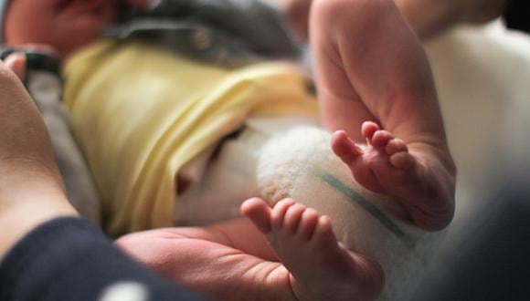 Rusia: Médicos cortan el rostro de bebé recién nacida durante cesárea y queda desfigurada. (Getty/Referencial)