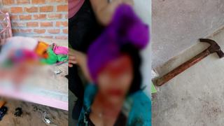 Sullana: Mujer denuncia a conviviente por atacarla a martillazos en la frente y dejarla mal herida