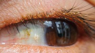 Cuide sus ojos: mal uso de pestañas postizas podría causar enfermedades