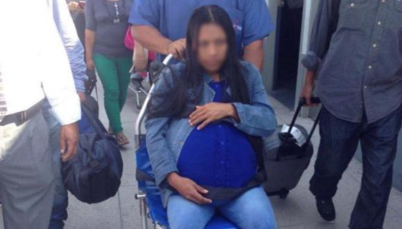 Extirparán tumor de 15 kilos a mujer nativa de Loreto en hospital Loayza. (Min. de Salud)