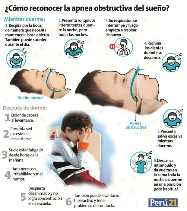 Nublado Arancel golpear Salud21: Desórdenes de los niños que roncan | VIDA | PERU21
