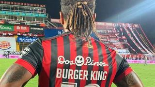 Futbolista costarricense tuvo que cambiar su apellido a "Burger King” por contrato de patrocinio