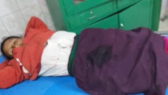 Una mujer quedó herida de bala en el enfrentamiento entre ronderos y la Policía en el distrito de Chugay.