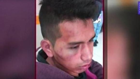 Pablo Barrientos Campos denunció que fue golpeado a las afueras de una discoteca de San Miguel. (Foto: Captura de video / 90 Matinal)
