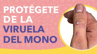 Esta es la campaña del Minsa para evitar contagios de viruela del mono en lugares nocturnos