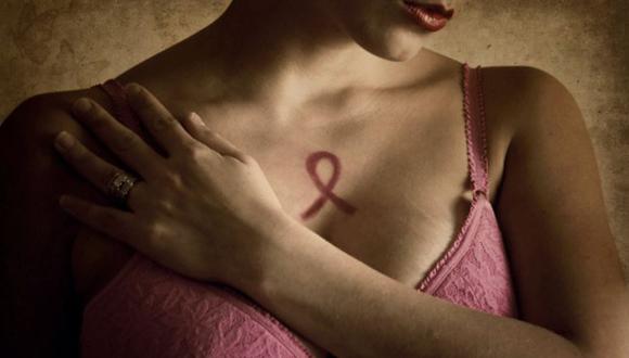 Cercar de 1,858 mujeres mueren por cáncer de mama en el Perú. (Getty Images)