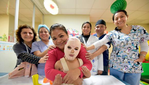 En lo que va del año 2022, el Instituto Nacional de Salud del Niño San Borja, atendió a 237 niños con quemaduras graves. Foto: INSN San Borja