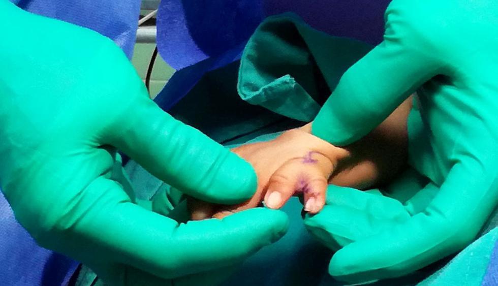 Los niños serán operados durante la campaña de reconstrucción de manos denominada “Manitos sanas y felices II”, que se llevará a cabo de forma conjunta con médicos de la Universidad Yale. (Foto: Difusión)