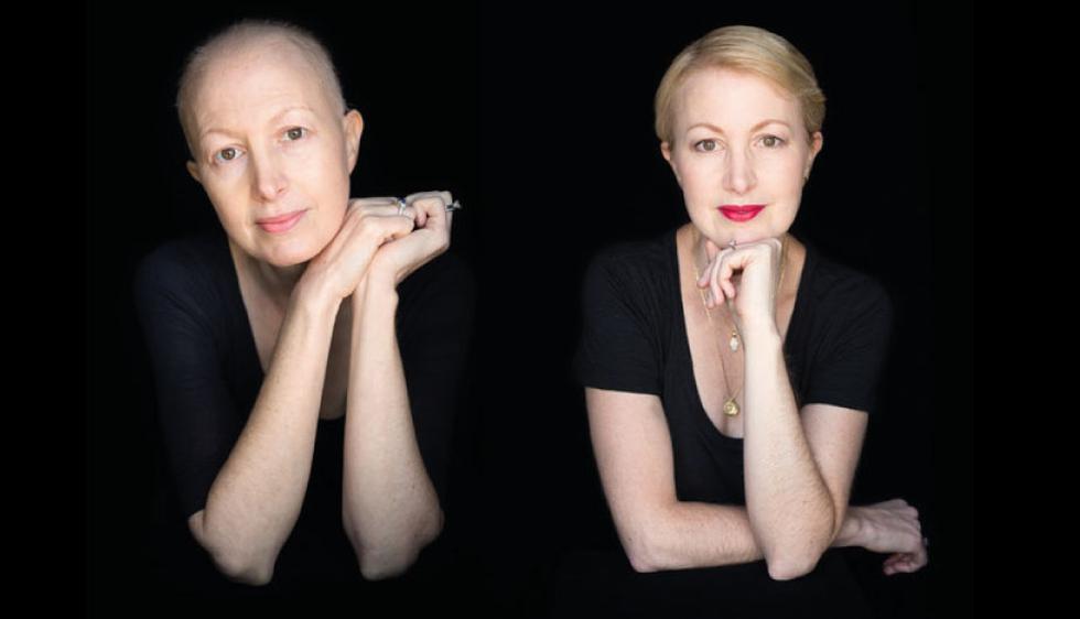 Estos retratos capturan la dura lucha contra el cáncer (Robert Houser)