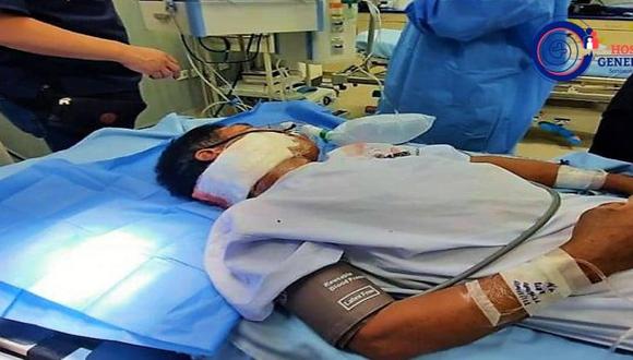 Virgilio Quispe Huanca se recupera tras la delicada operación.(Foto: Hospital General de Jaén)