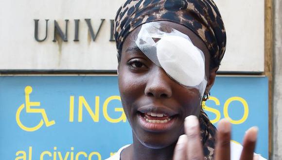 Daisy Osakue habla con los periodistas frente a un hospital en Turín, Italia. Osakue, de 22 años, corre el riesgo de perderse el Campeonato de Europa de Atletismo después de ser golpeada en el ojo con un huevo que dañó su córnea. (Foto: AP)