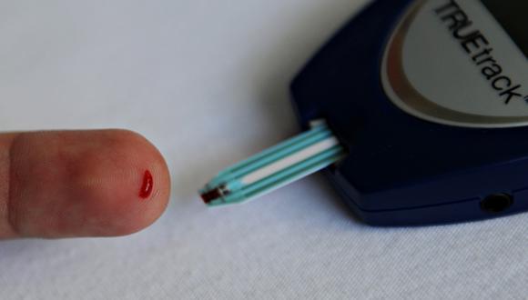 El INSN estima que los casos de diabetes tipo 1 no superan el 1 por 100 mil habitantes.