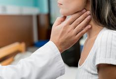 Cáncer de tiroides: Cinco mitos y verdades que todo peruano debe saber