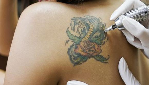 ¿Eres amante de los tatuajes o quieres hacerte uno? Ten en cuenta estas advertencias. (USI)