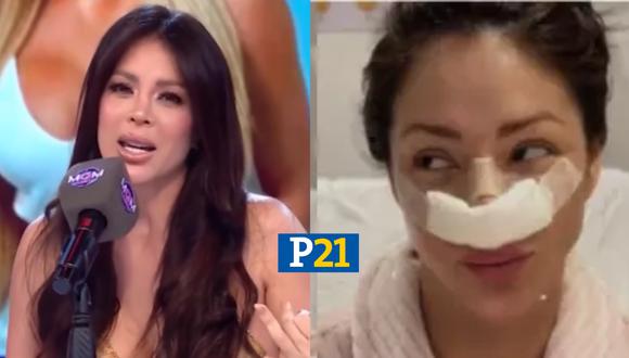 Sheyla Rojas arrepentida de tantas cirugías en su rostro. (Imagen: América TV)