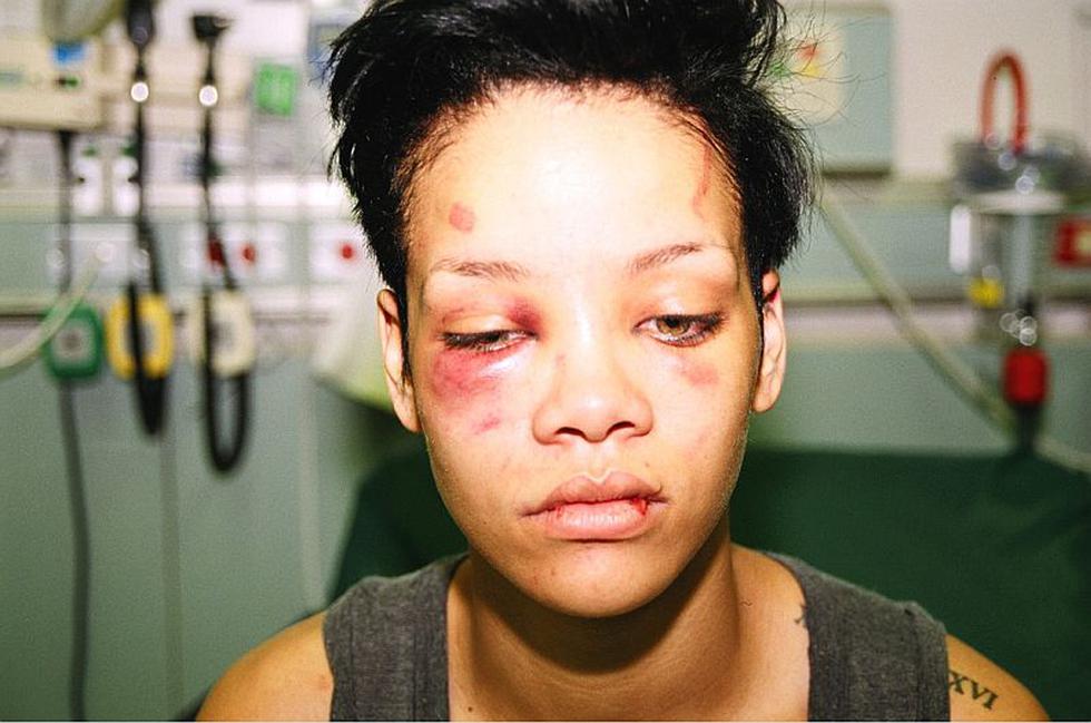 La cantante Rihanna fue golpeada en plena calle por su exnovio Chris Brown. (Internet)