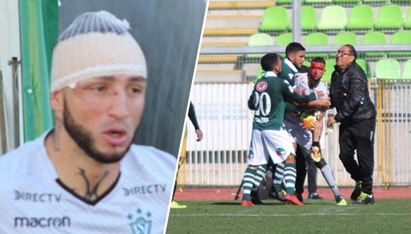 Mauricio Viana, exarquero de Sporting Cristal, sufrió corte, terminó ensagrentado, pero siguió jugando. (Santiago Wanderers / Awante.cl)