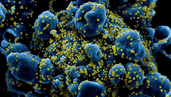 ¿Cómo el coronavirus ataca las células humanas? (NIAID)