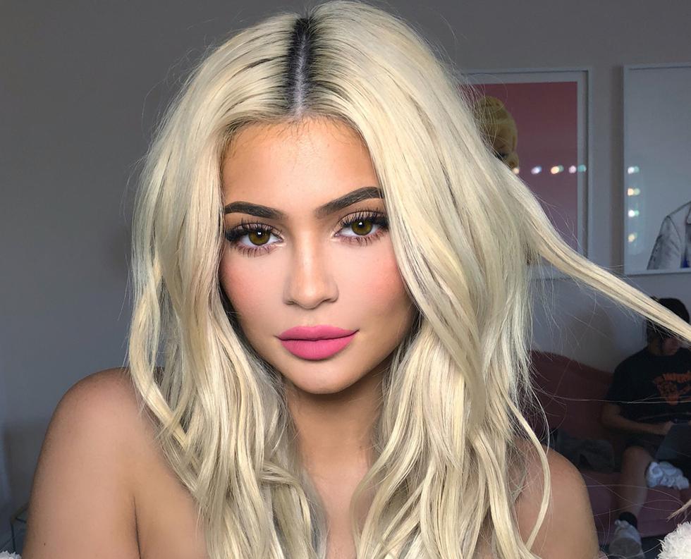 Kylie Jenner volvió a aplicarse ácido hialurónico para lucir unos labios voluminosos.