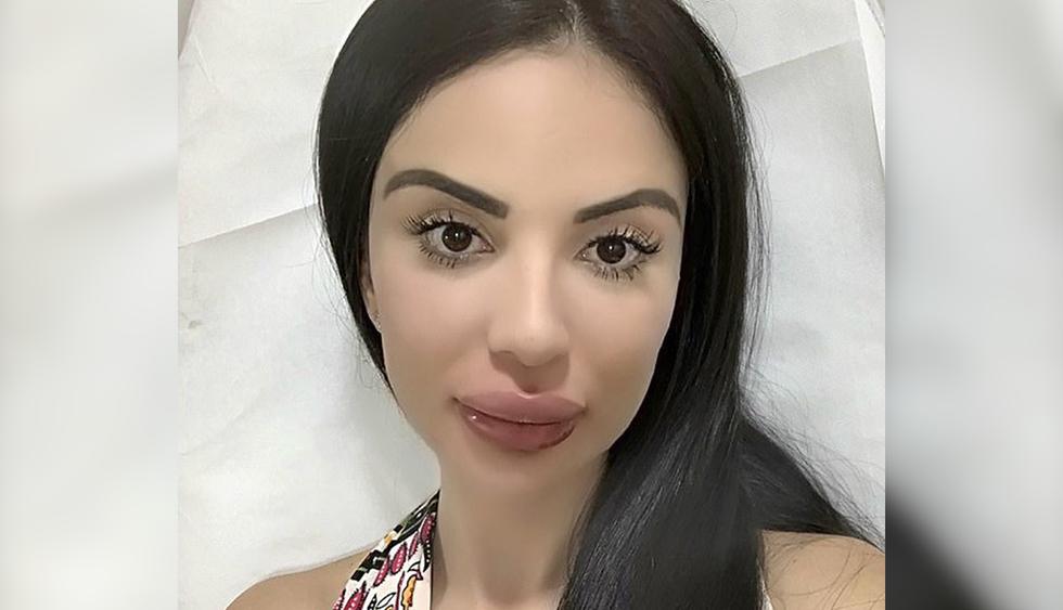 Joven gasta 500 mil dólares en cirugías para parecerse a Kim Kardashian pero termina con "labios de pescado". Su historia es viral en redes sociales. (Facebook)