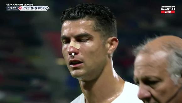 Duro choque de Cristiano Ronaldo con el guardavallas de la selección de República Checa. (Video: Captura ESPN)