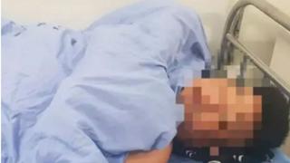Mujer corta miembro de su pareja en Vietnam tras descubrir que abusaba de su hija