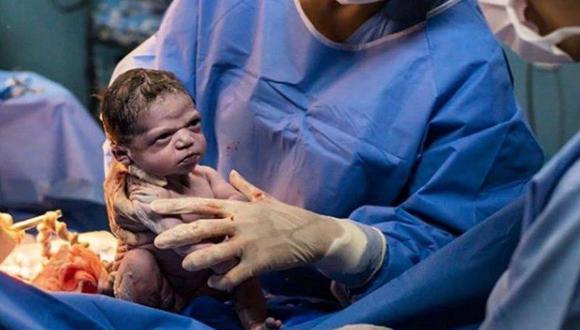 “Mi hija nació con cara de meme”: La historia de la bebé enojada que se ha vuelto viral en Internet. (Facebook)