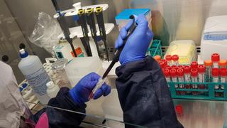 Enfermedades raras: Perú cuenta con el primer laboratorio para detectar males genéticos en tiempo récord