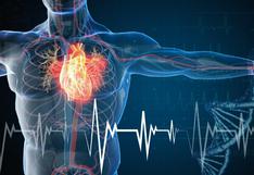 Sociedad Peruana de Cardiología: ¿Cuántos peruanos sufren infarto al día?