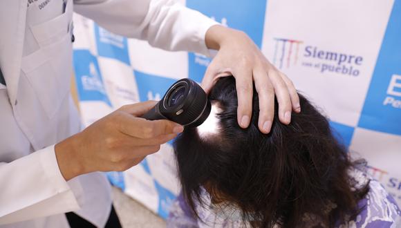 Especialista manifestó que, según estudios, alrededor del 60% de mujeres pueden reportar caída del cabello mientras que solo el 20% de varones presentan el mismo problema.