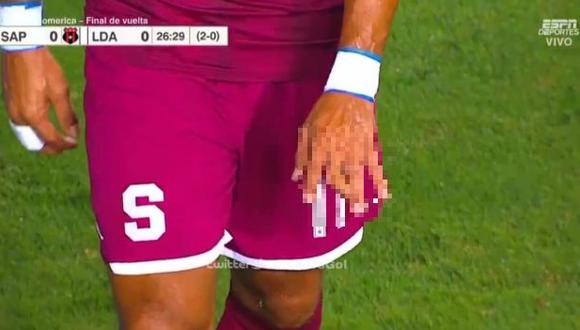 Jugador de Saprissa sufrió una impactante lesión en el dedo. (Captura: ESPN)
